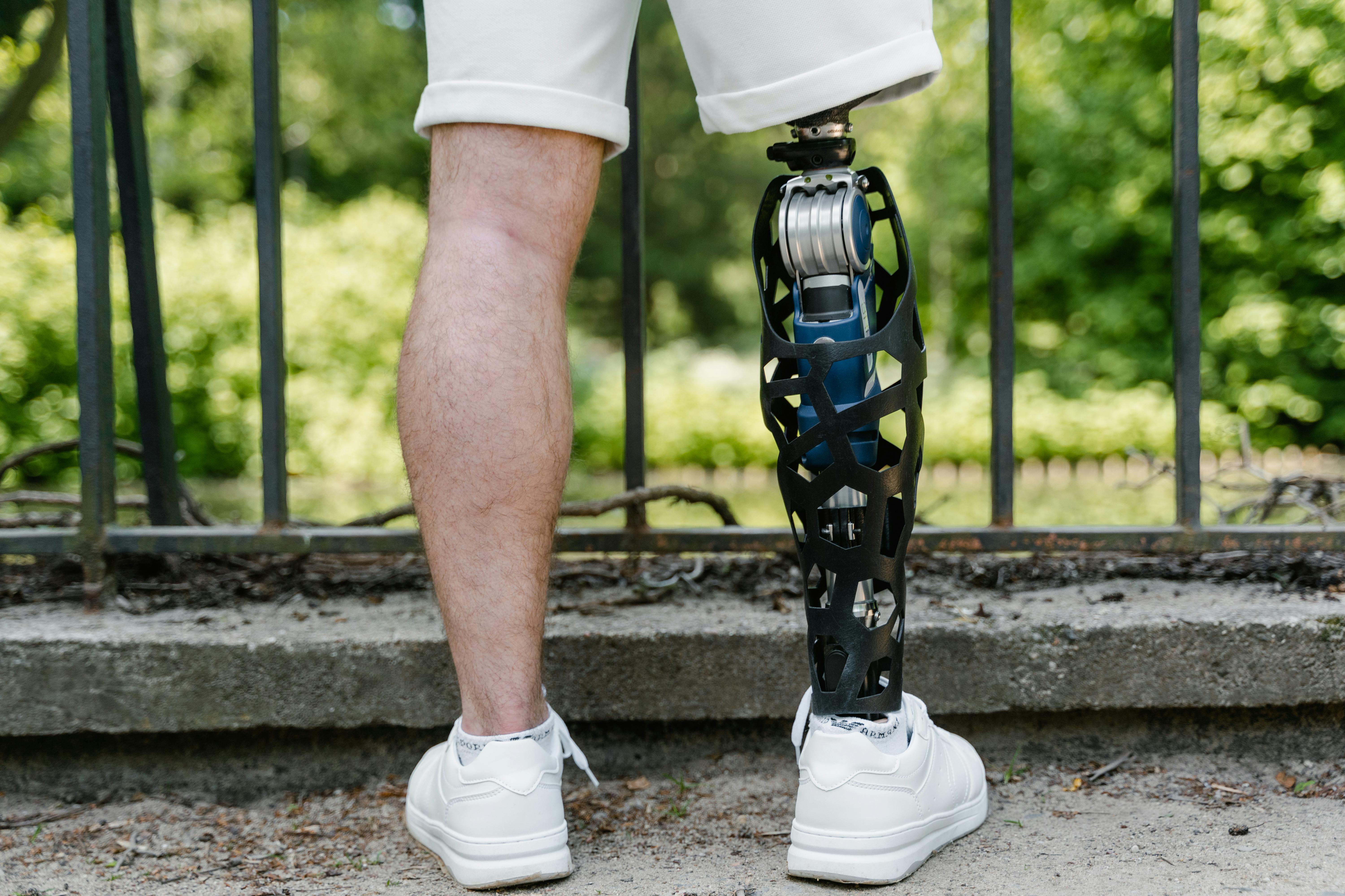 Smart Prosthetic Limb